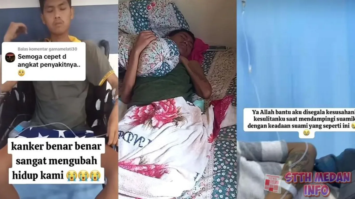 Potret Ary Sinaga, Penyintas Kanker - Tiktok